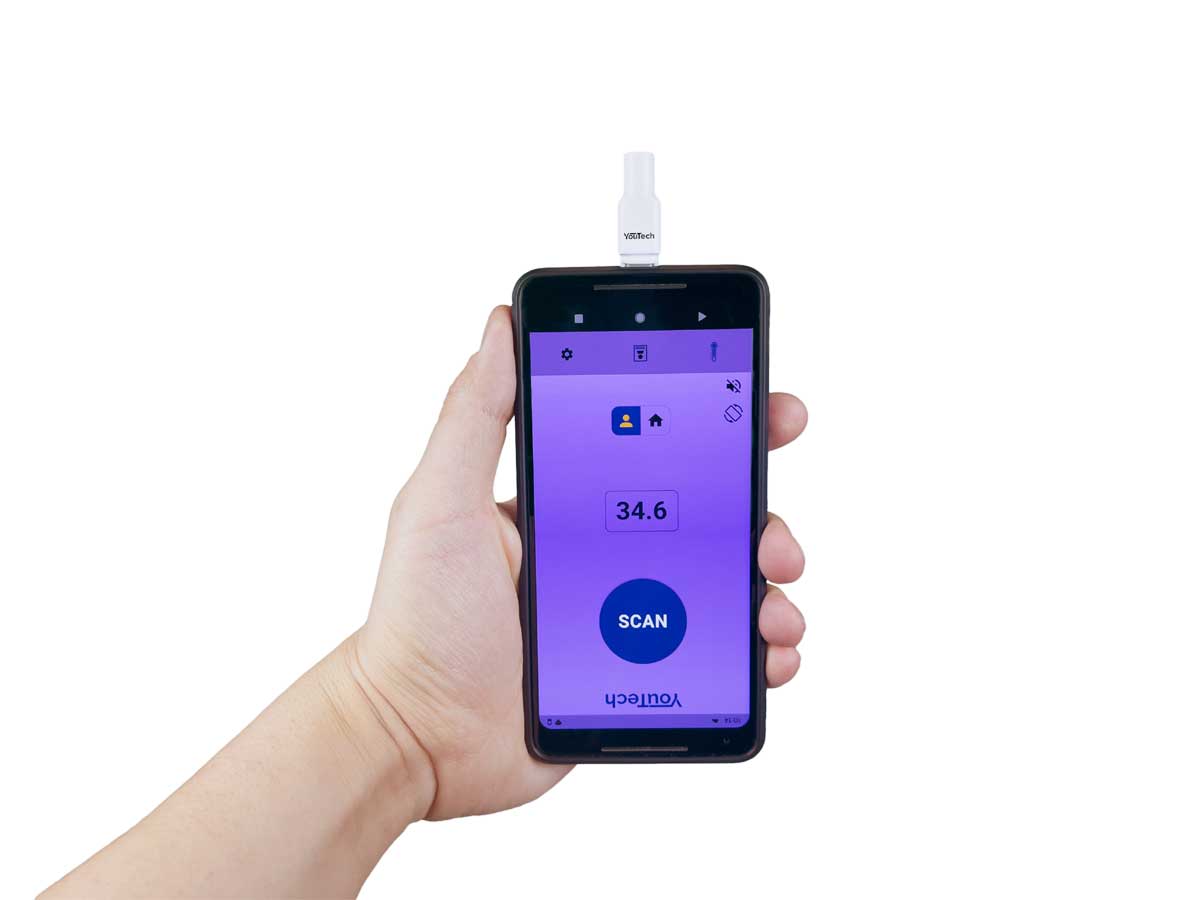 Read more about the article Check Body Temperature | Convert Smartphone into a thermometer